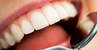Periodontal Dental Care